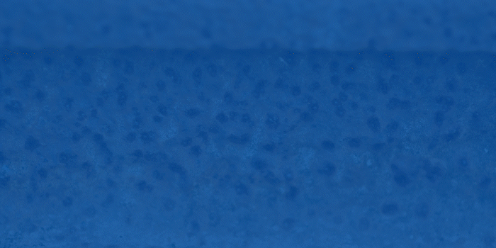 스테인리스강에 발생한 공식(Pitting corrosion) 및 틈새 부식(Crevice corrosion)을 비교하는 그래픽 이미지