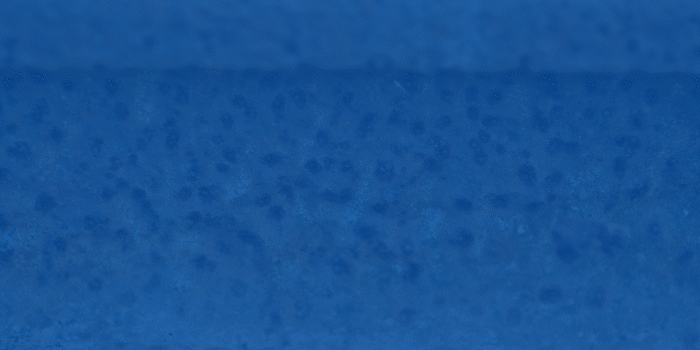 Grafische Gegenüberstellung von Lochfraß und Spaltkorrosion bei Edelstahl